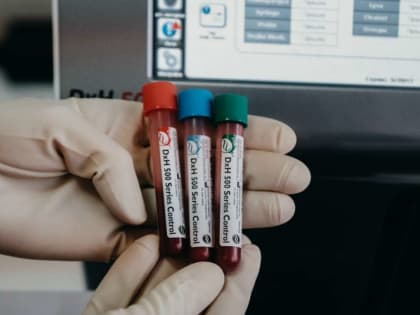 Исследование постковидного синдрома в Красноярске