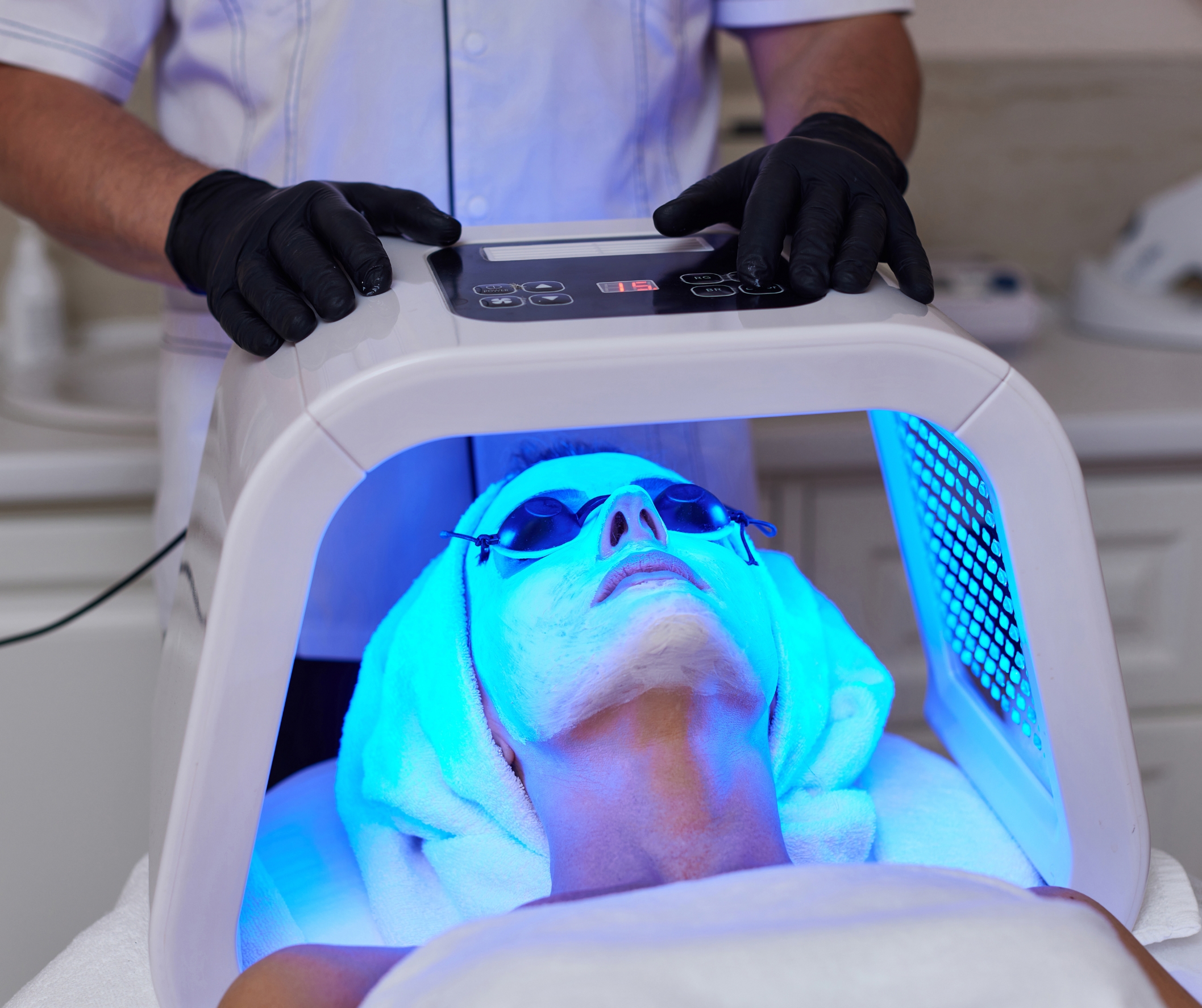 NB-UVB Phototherapy Research