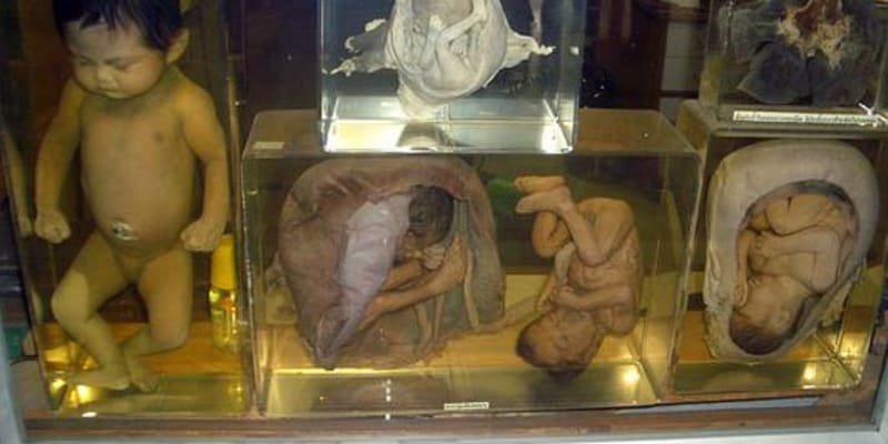 Siriraj Medical Museum