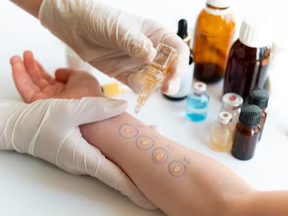 Врач-аллерголог Гульнара Меметова перечислила самые частые причины аллергии россиян