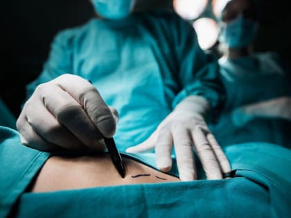 Операцию по удалению почки впервые провели в КЧР