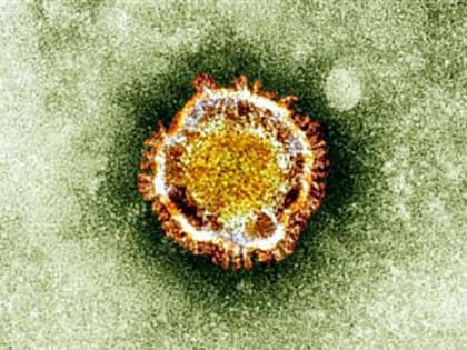 Мониторинг Covid-19 в Карачаево-Черкесской Республике