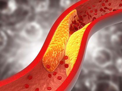 Для чего нужен и как себя ведет в нашем теле холестерин