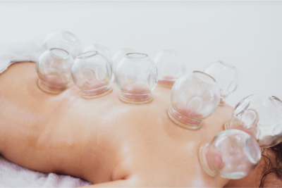 Cupping Therapy Session 5