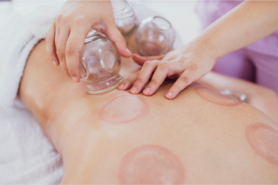 Cupping Therapy Session 4