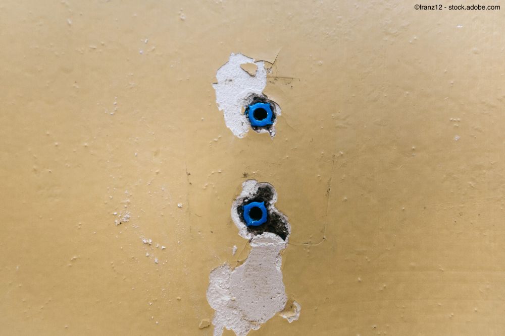 Unschöne Dübellöcher in den Wänden