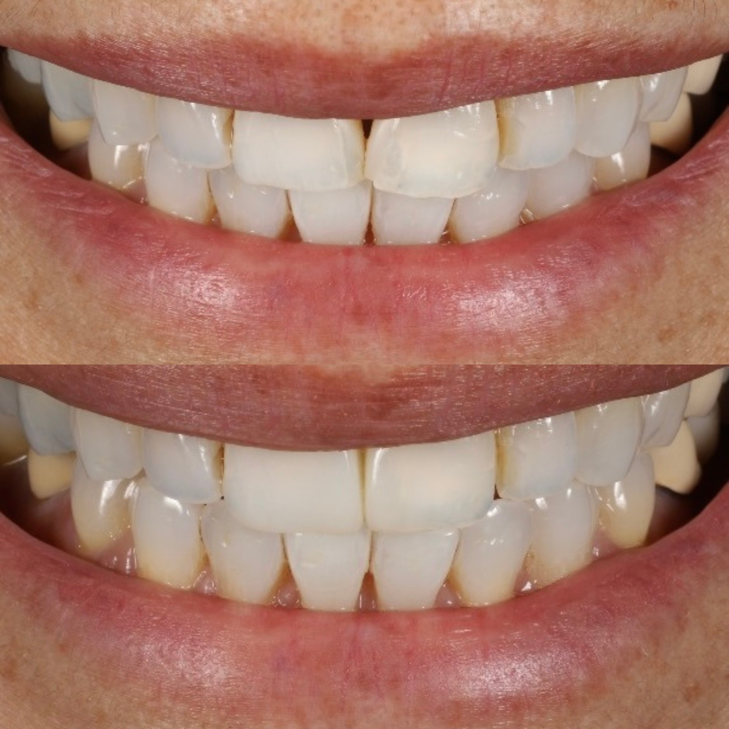 Correct & Improve Your Smile