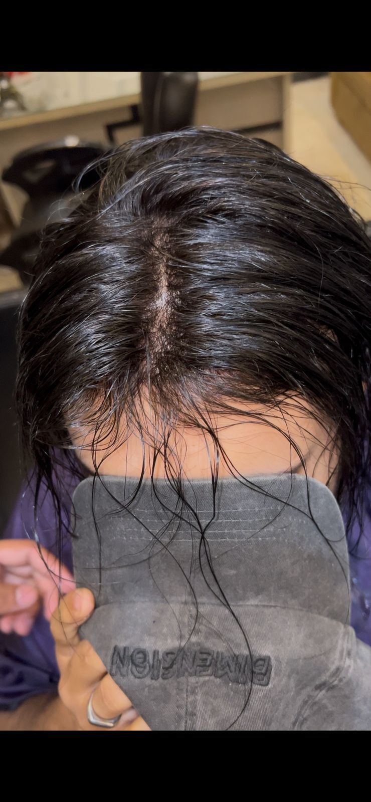 Thin Skin Hair Patch