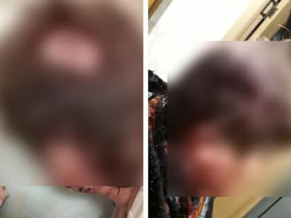 В Туле женщина избила педиатра: полиция устанавливает обстоятельства происшествия