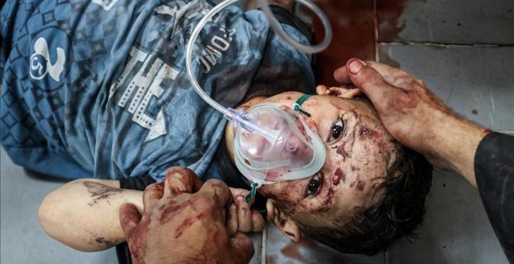UNICEF: Israel Bunuh 45 Anak di Gaza dalam Dua Hari