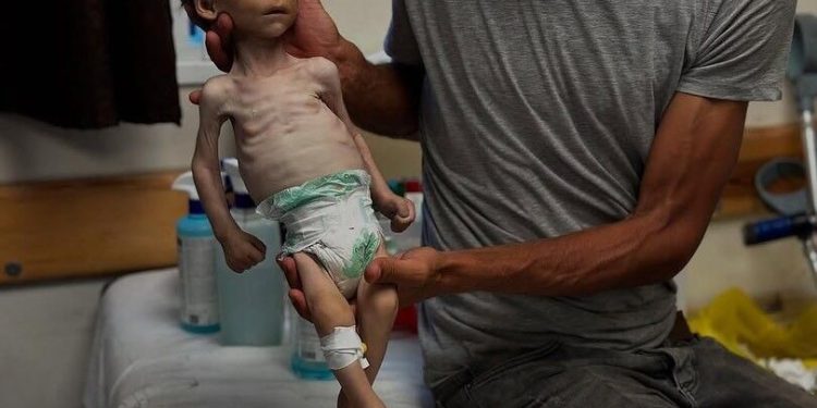 Israel Makin Getol Jadikan Kelaparan Sebagai Senjata Membunuh