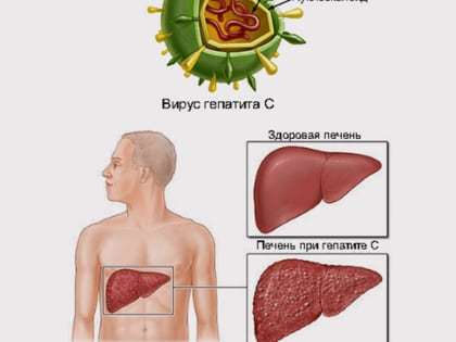 Неделя по борьбе с заражением и распространением гепатита С.