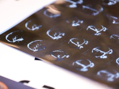 За год во флагманском центре НИИ Склифосовского получили помощь более 55 тысяч человек