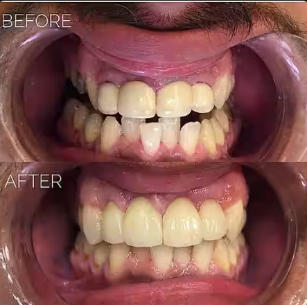 Before treatment
