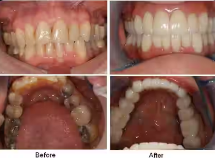 After treatment
