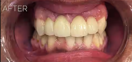 After case 1