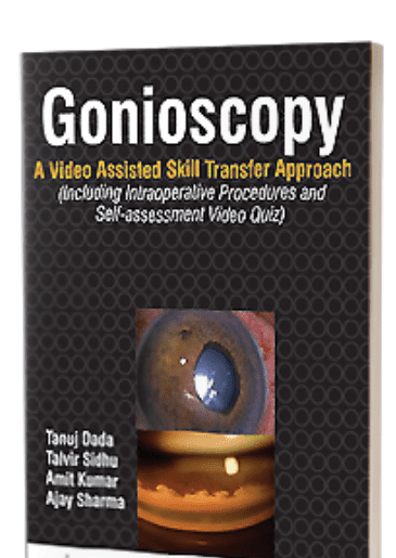 Gonioscopy A Video Assisted Skill Transfer Approach (Including Intraoperative Procedures and Self-assessment Video Quiz)