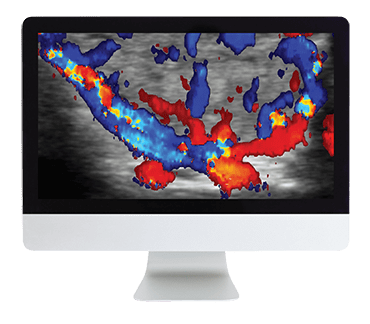 ARRS Thyroid Imaging 2019 (CME VIDEOS)