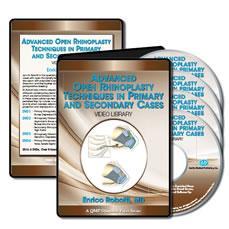 Advanced Open Rhinoplasty Techniques in Primary and Secondary Cases