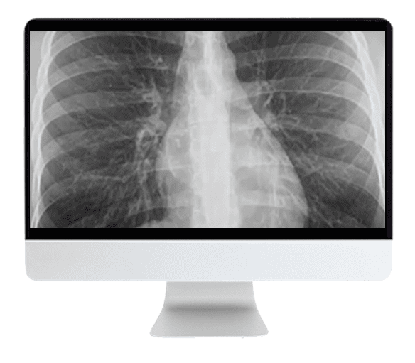 ARRS Liver, Pancreatic, and Biliary Tumors 2022 (Videos + CME Questions)