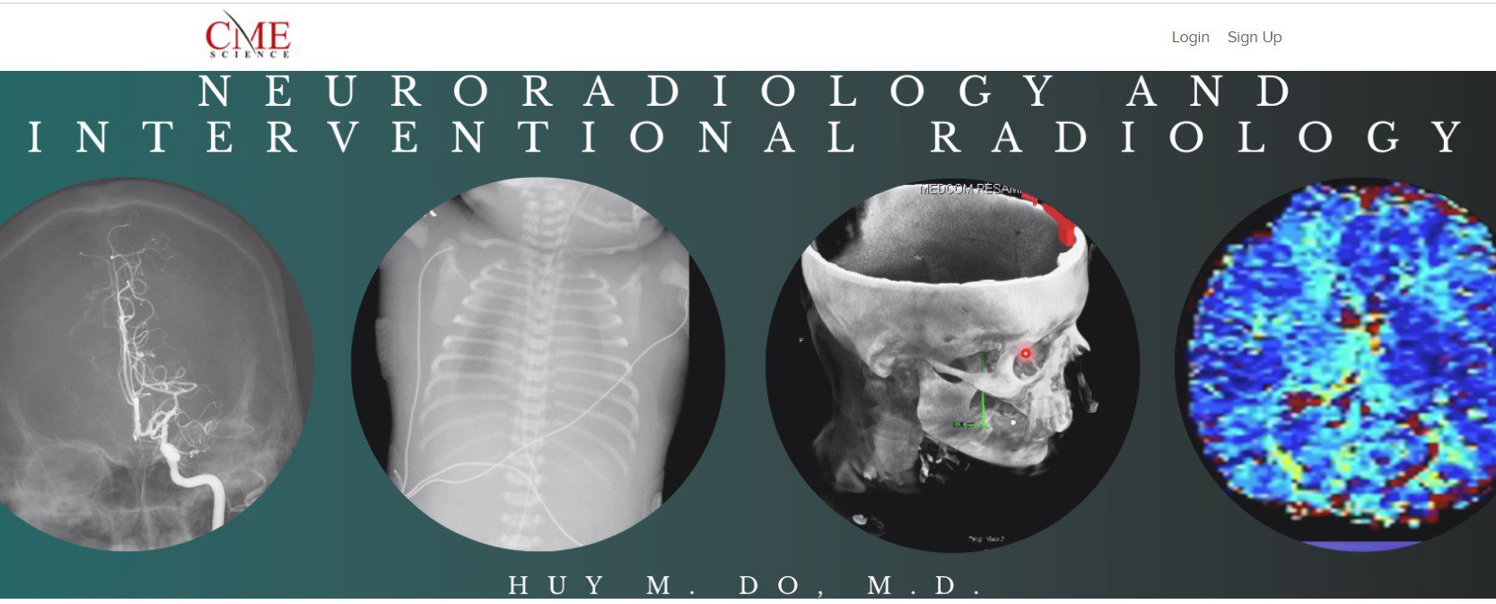 Cmescience Neuroradiology and Interventional Radiology 2020 (CME VIDEOS)