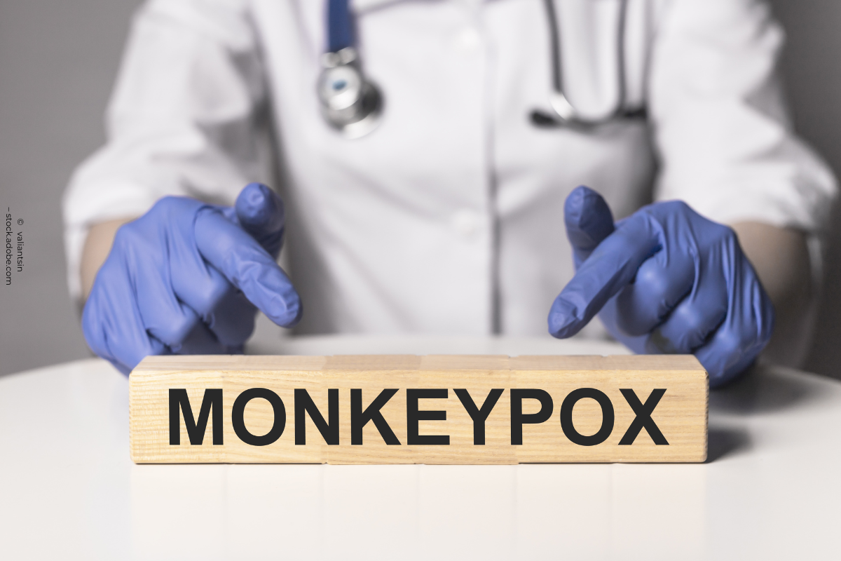 Ein Arzt in weißem Kittel und mit Stethoskop zeigt mit behandschuhten Händen auf einen Holzblock mit der Aufschrift "MONKEYPOX". Weitere Details der Umgebung sind unscharf.
