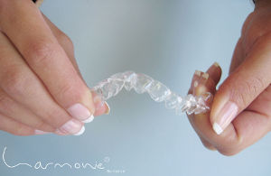 HarmonieSchienen flexibel Zahnarzt Norbert Kruse