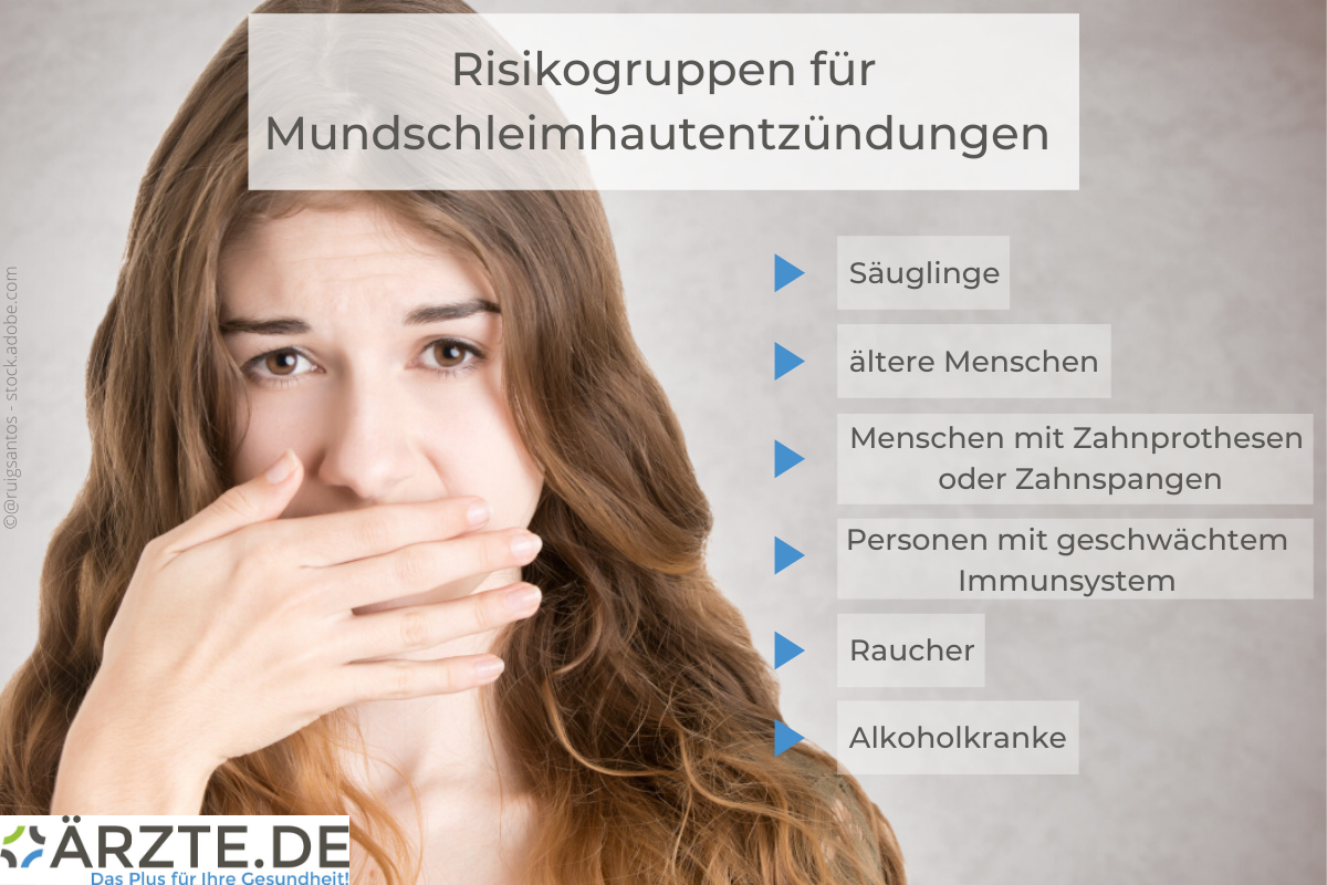 Risikogruppen bei Mundschleimhautentzündungen