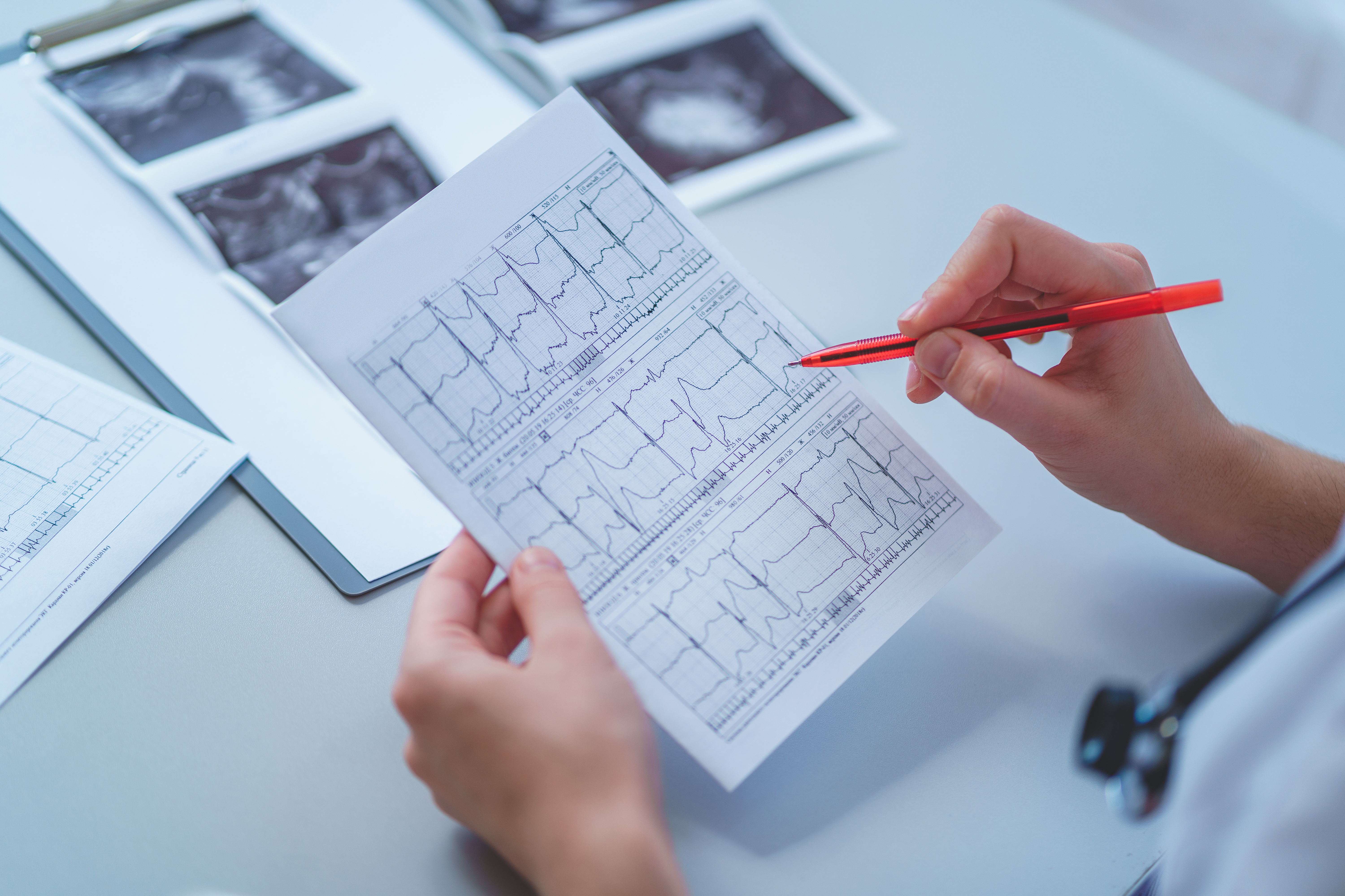 Arzt liest EKG