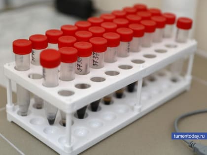 Тестирование на ВИЧ в Тюмени: мероприятия к Всемирному дню борьбы со СПИДом