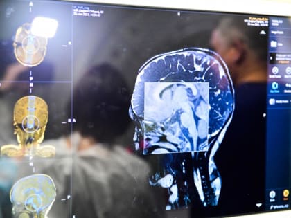 Тюменский медик рассказала, как поддержать здоровье мозга в любом возрасте