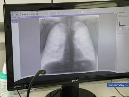 Специалисты тюменского «Медгорода» назвали факторы возникновения онкологии