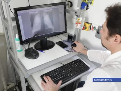 За год диспансеризацию в Тюменской области прошли почти 700 тысяч человек