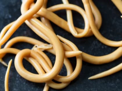 В Тюменской области резко выросли случаи заражения глистами