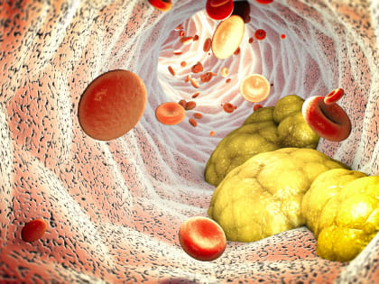 Диетолог Соломатина заявила о необходимости холестерина организму
