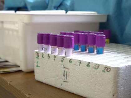 День донора пройдёт в Истре