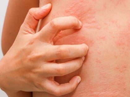 В Тульскую область пришла опасная болезнь