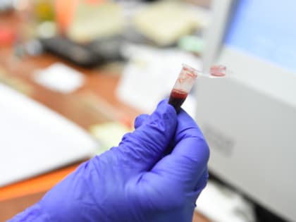 Pharmaceutics: В России научились определять рак мозга на ранней стадии по анализу крови