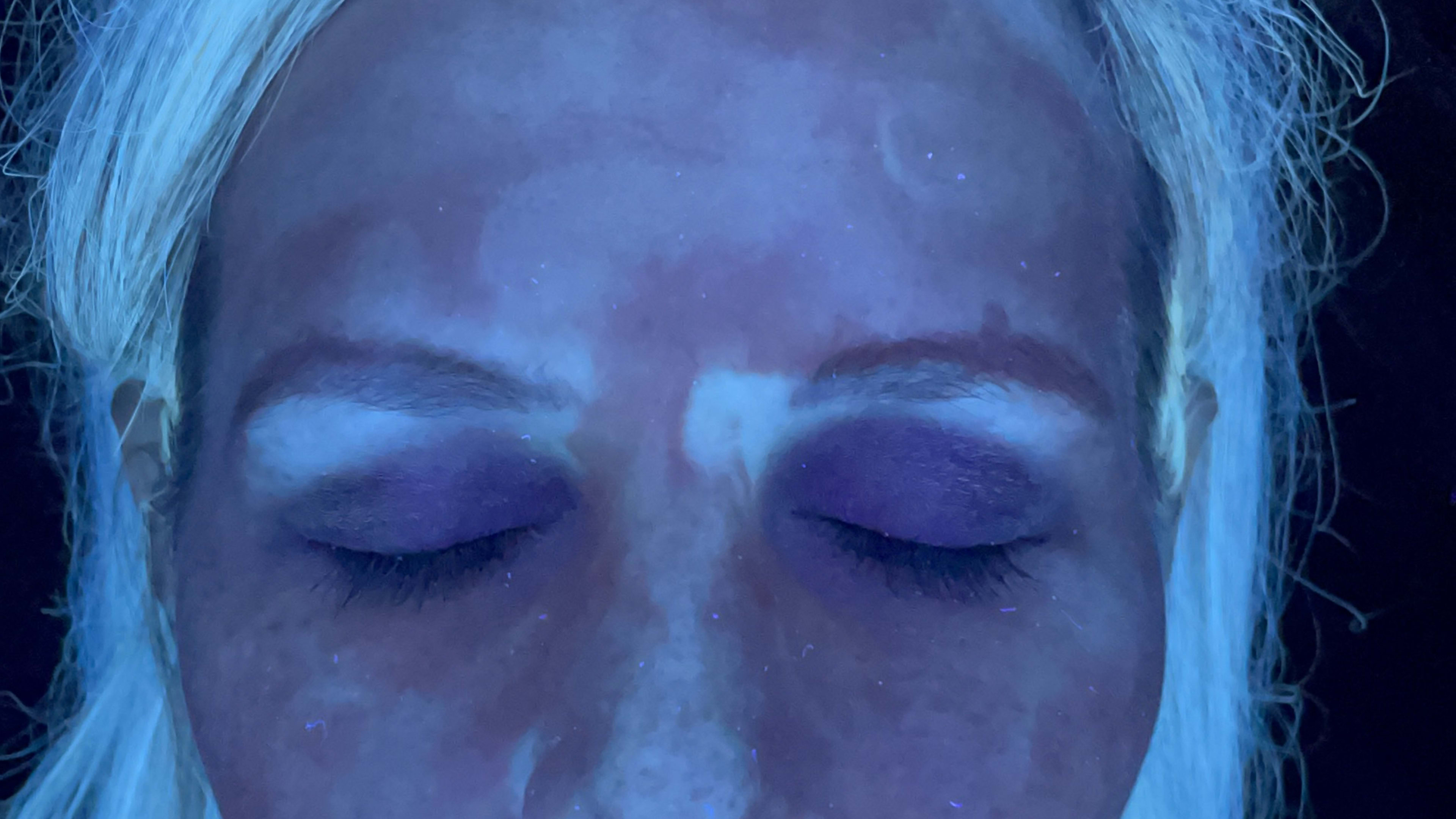 Understanding Medical Grade Skincare