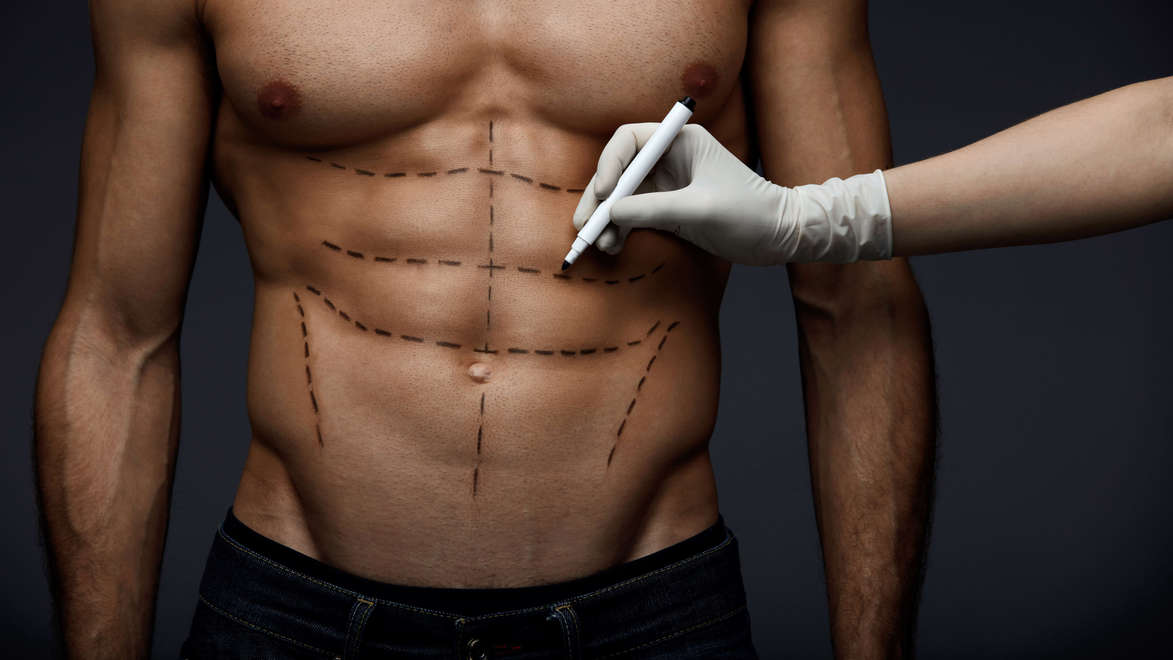 Rib Modeling Technique