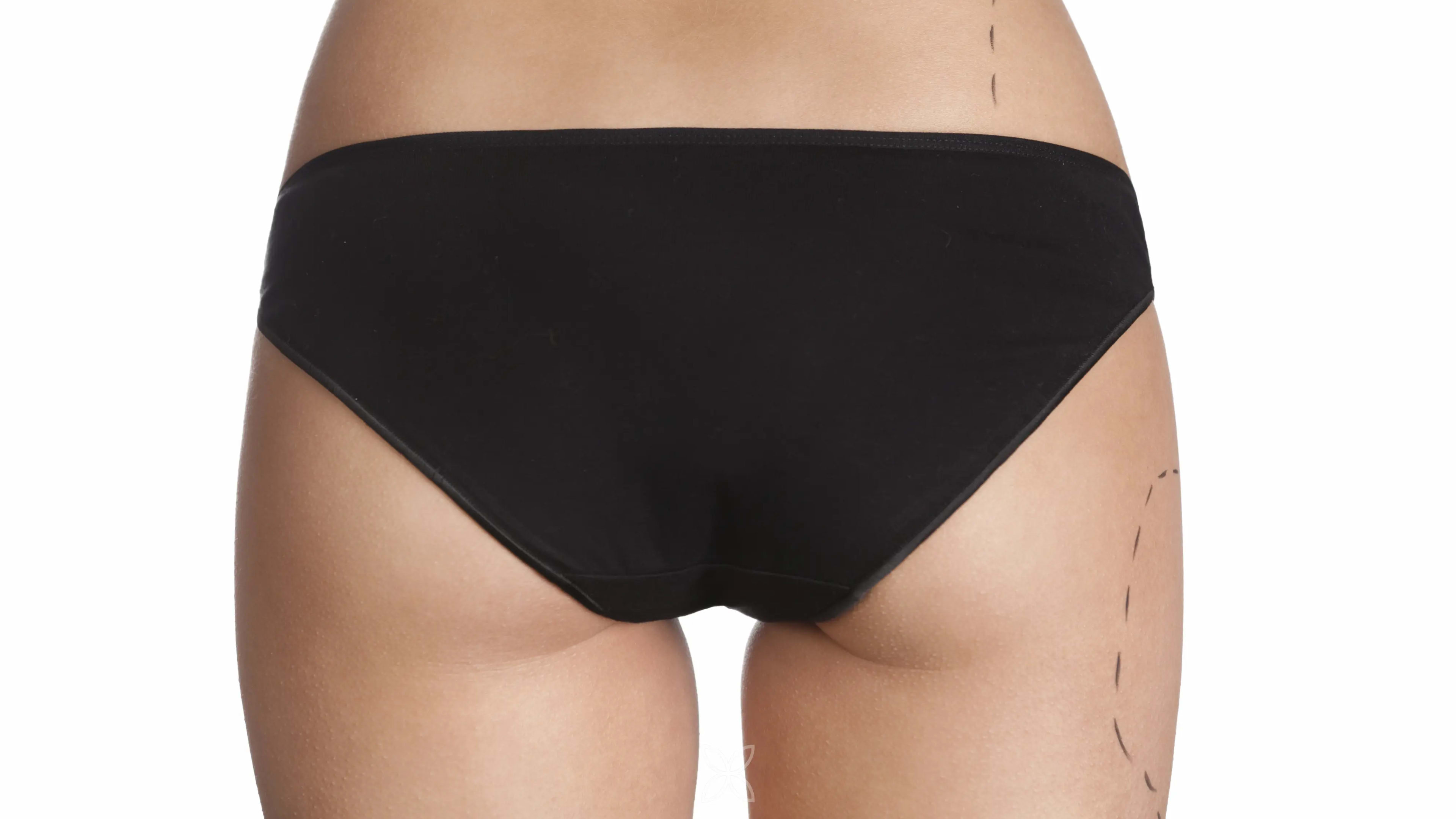 MicroAire Power-Assisted Liposuction