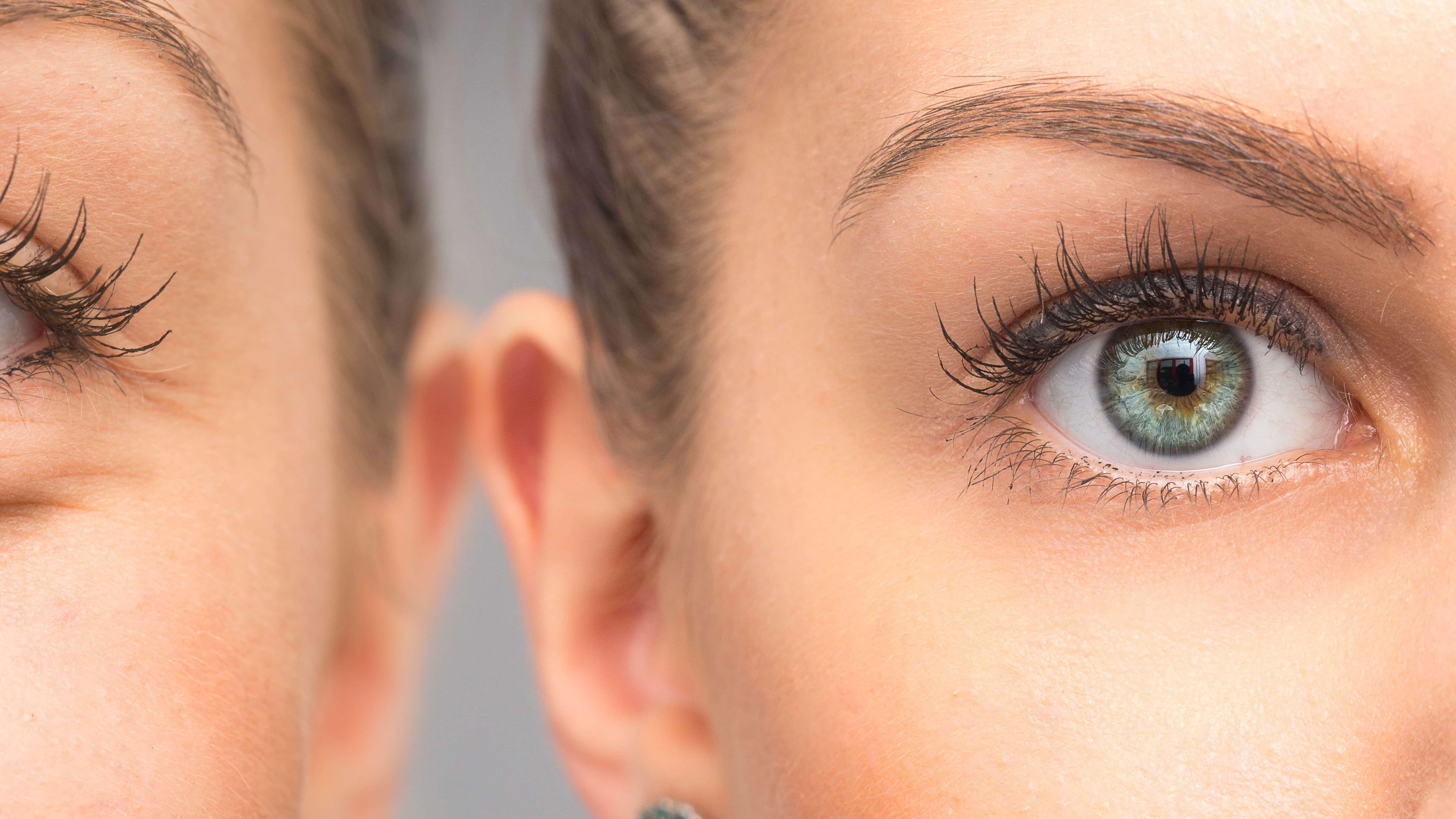 Blepharoplasty vs. Ptosis Repair: Is It Excess Skin or a Drooping Lid?