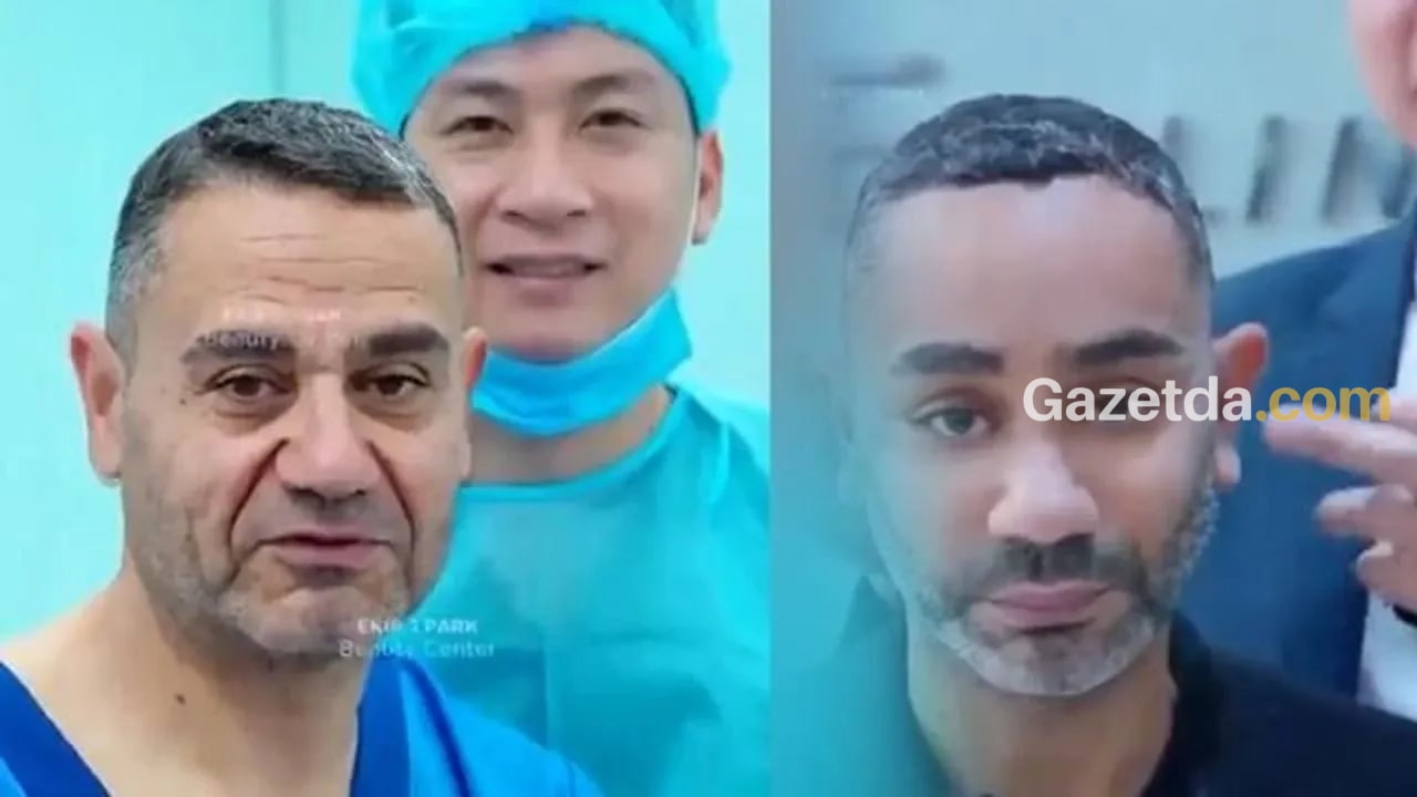 Vietnam'da yüz gençleştirme operasyonu sonrası 20 yaş gençleşme iddiası sosyal medyada tartışma yarattı