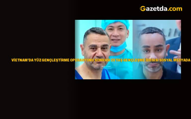 Vietnam'da yüz gençleştirme operasyonu sonrası 20 yaş gençleşme iddiası sosyal medyada tartışma yarattı