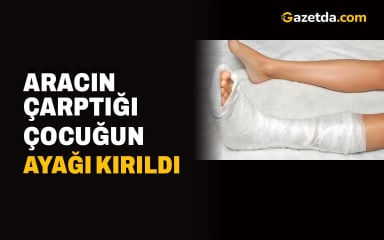 Aracın çarptığı çocuğun ayağı kırıldı