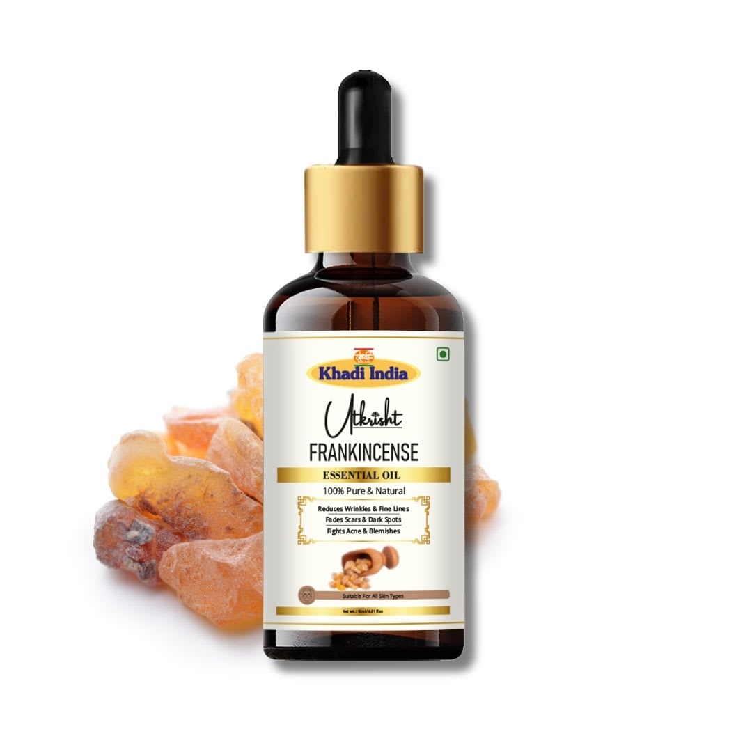 Frankincense Essential Oil