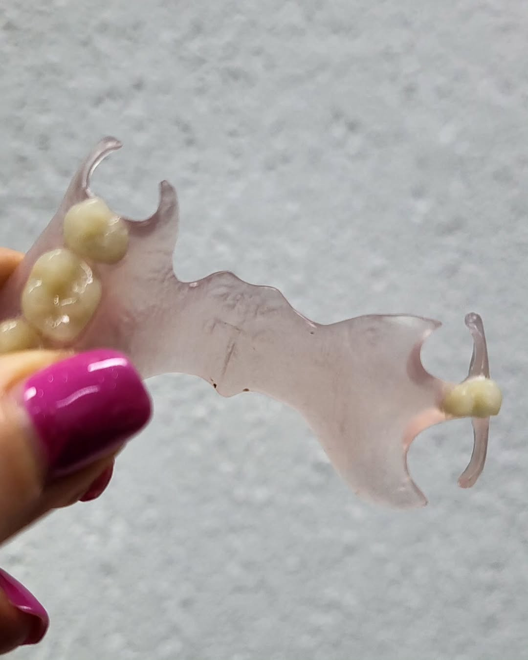 Novi tip termosens zubnih proteza