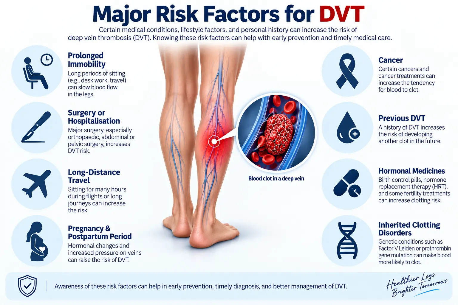 Major DVT risk factors including prolonged immobility, surgery, long-distance travel, pregnancy, cancer and previous DVT