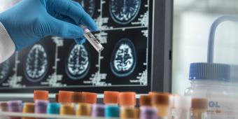 The key to tackling dementia: the Chancellor must act on early diagnosis
