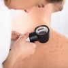 Allergy care must not be left to the NHS postcode lottery
